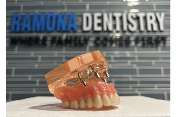 Dental Implants Fountain Valley