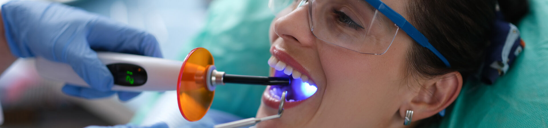 Dental Bonding