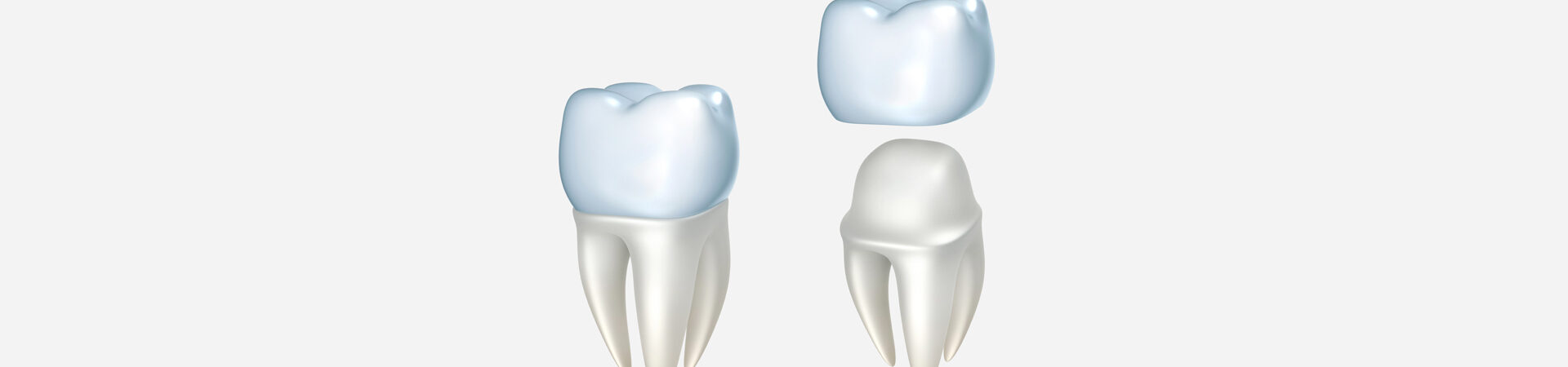 Dental Crowns