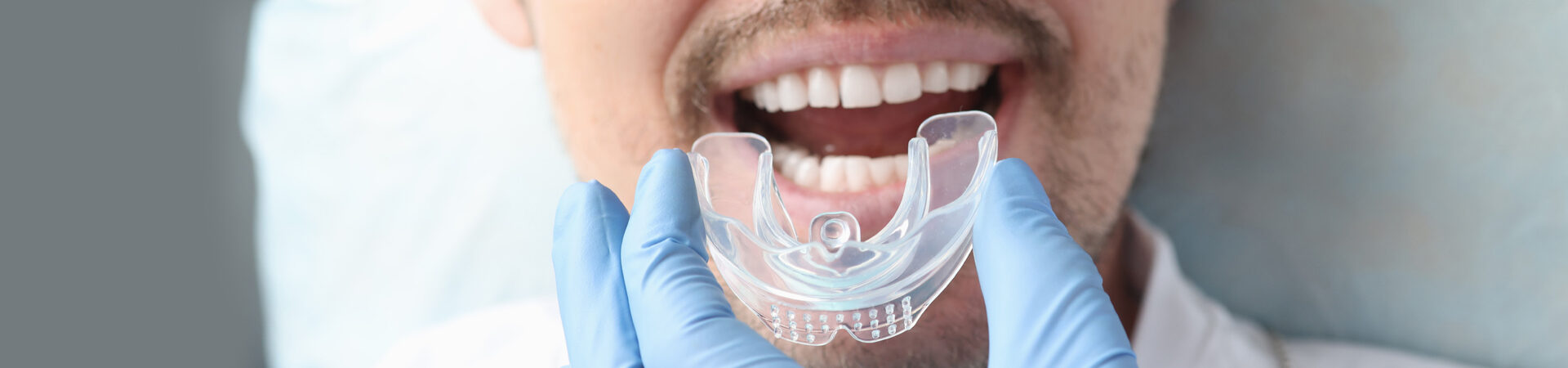 Mouth Guards