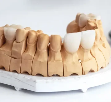 Can Veneers Fix Chipped, Stained, or Crooked Teeth?